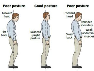 Anatomy of Poor Posture